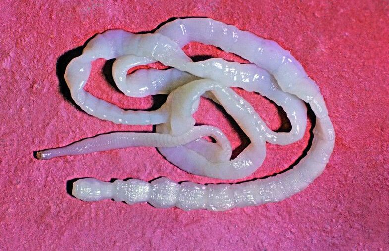 Bovine tapeworm is a common intestinal worm